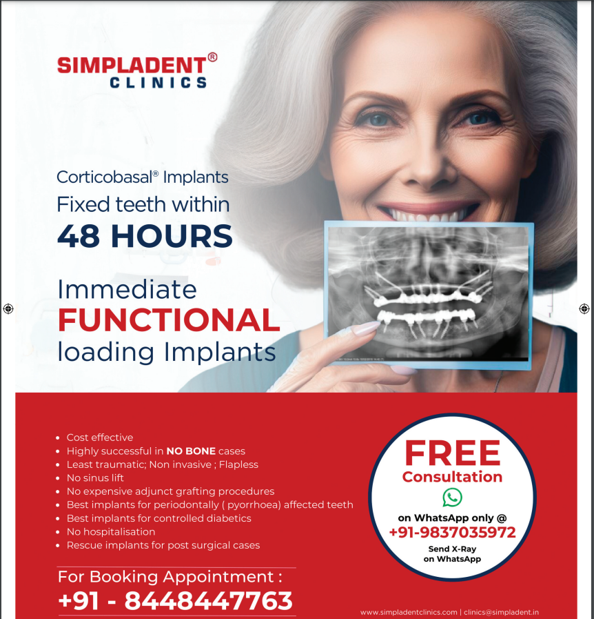 Say Goodbye to Waiting: Simpladent’s Immediate Loading Implants Offer Instant Results