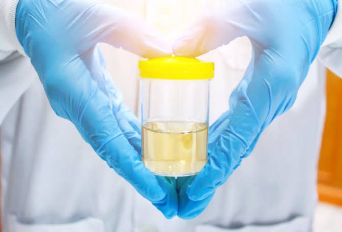What Does a Complete Urine Examination Involve? A Step-by-step Overview