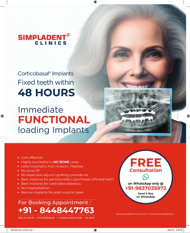 5 REASONS WHY SIMPLADENT IMMEDIATE LOADING DENTAL IMPLANTS ARE SO POPULAR