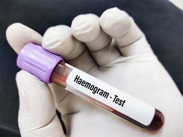 Why is a Hemogram Test Prescribed?