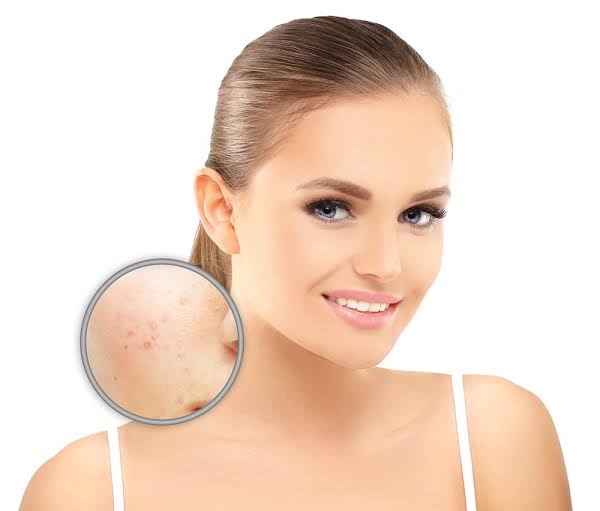 How to Reduce Skin Pigmentation?