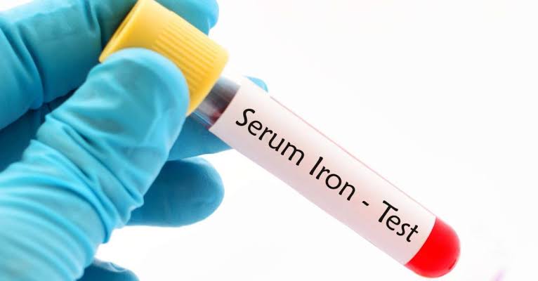 5 Signs You Need to Get an Iron Test Done