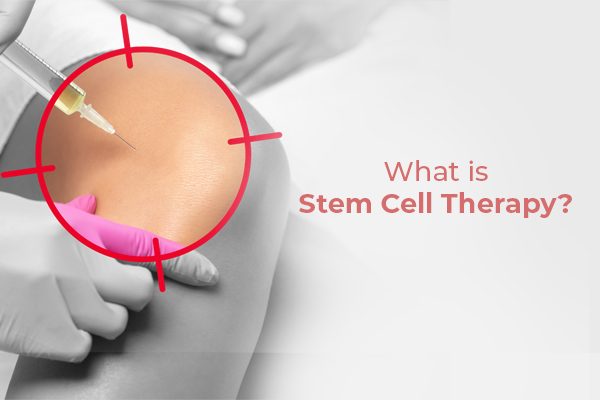 What Is Stem Cell Therapy? How Does It Work?
