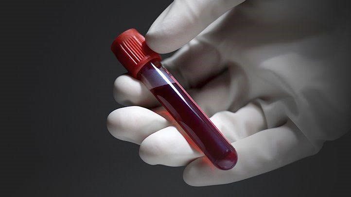 Which Blood Test Can Help Detect Infections?